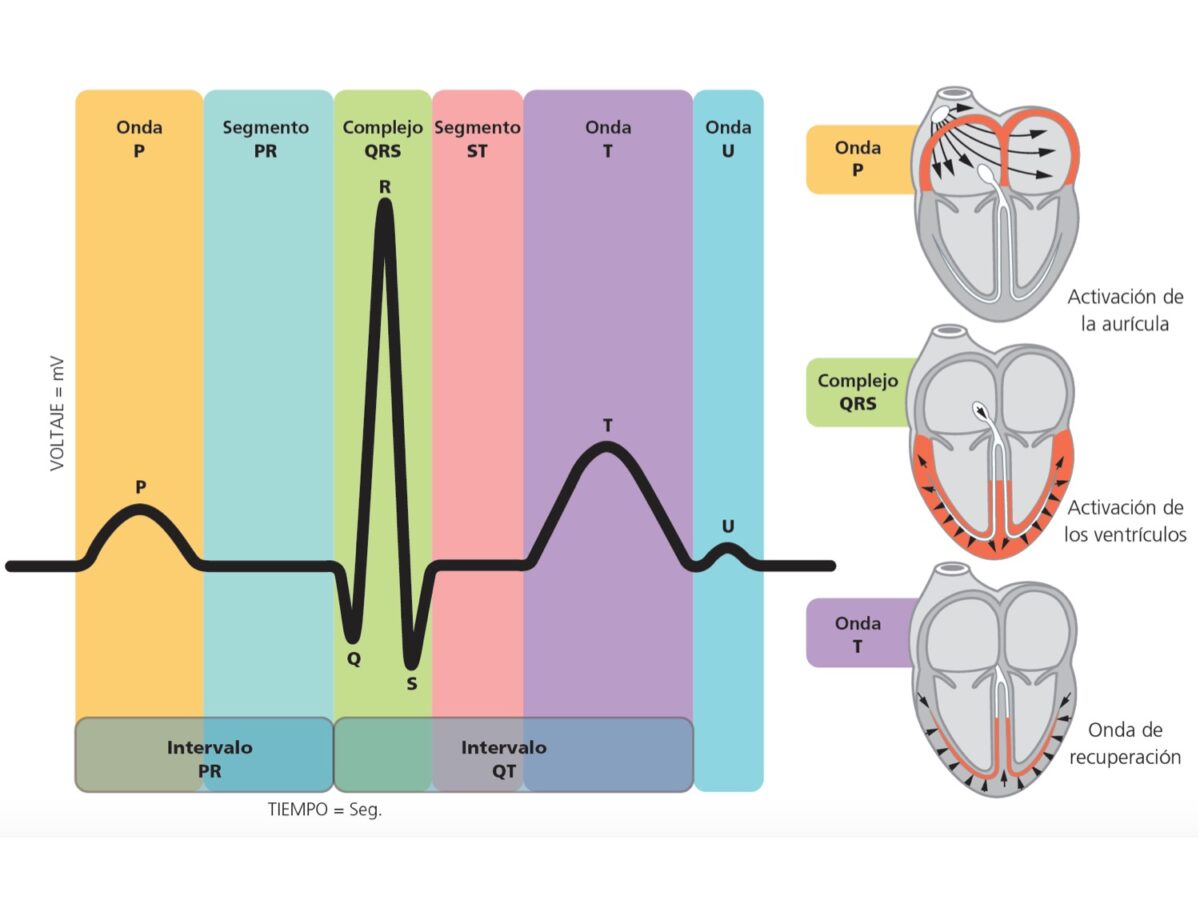 T cnica De Electrocardiograma Ecg Ekg EEKJRM