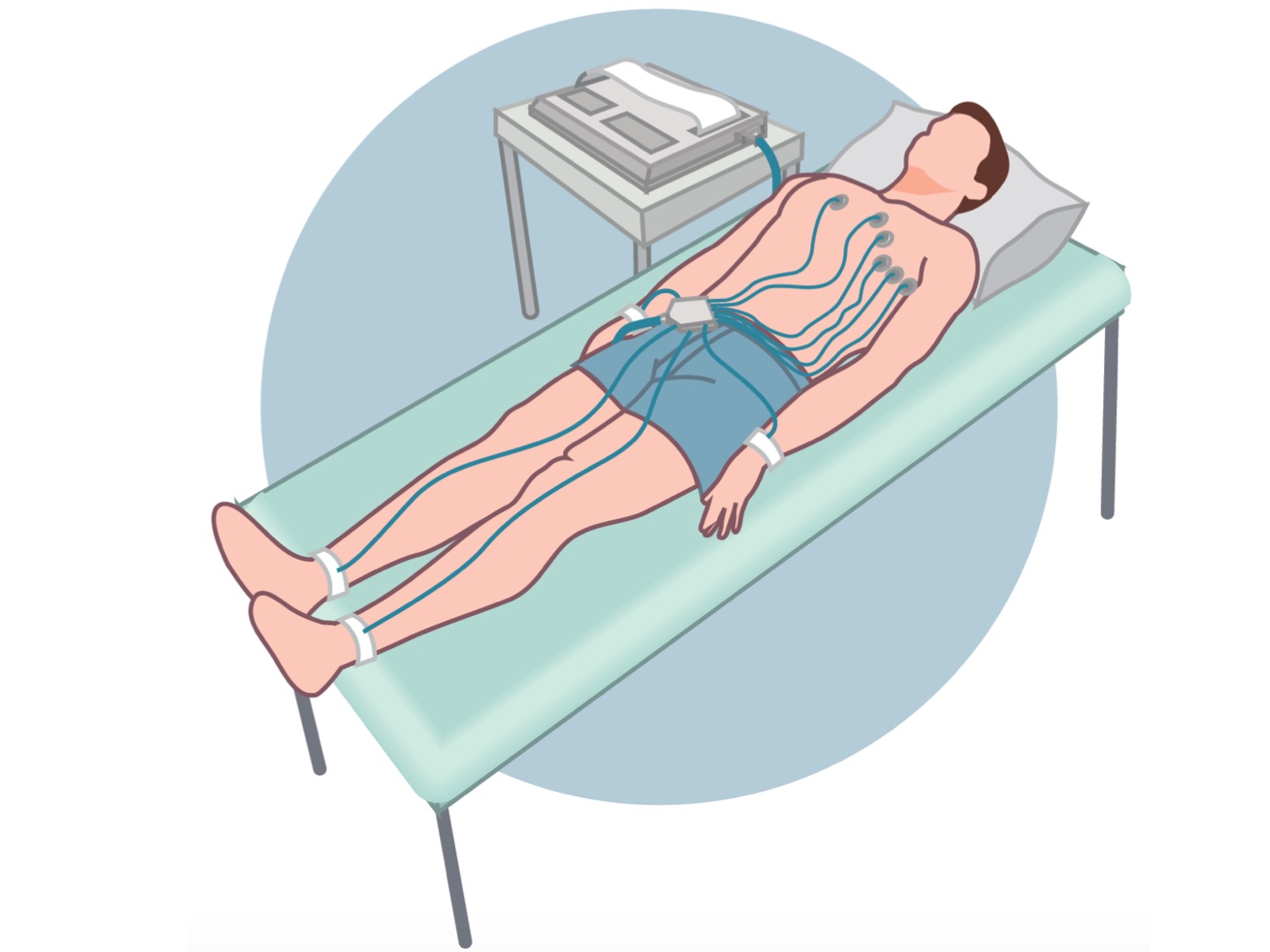 Electrocardiograma Dr Yitzar Ba uelos Mill n