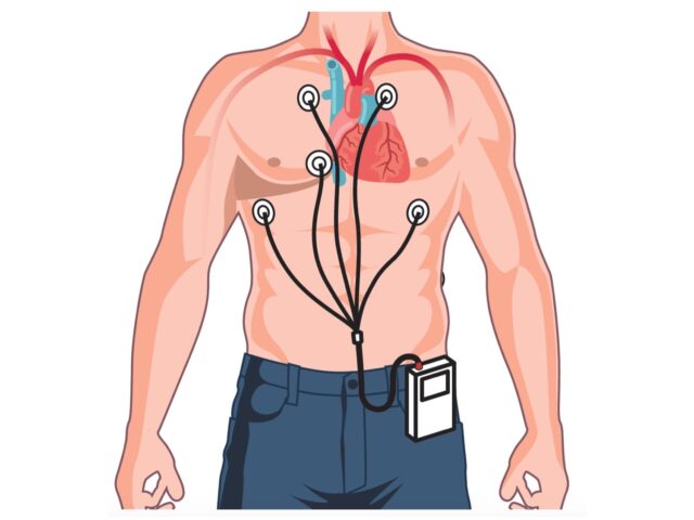 Monitoreo Ecg Tipo Holter Dr Yitzar Bañuelos Millán 8859